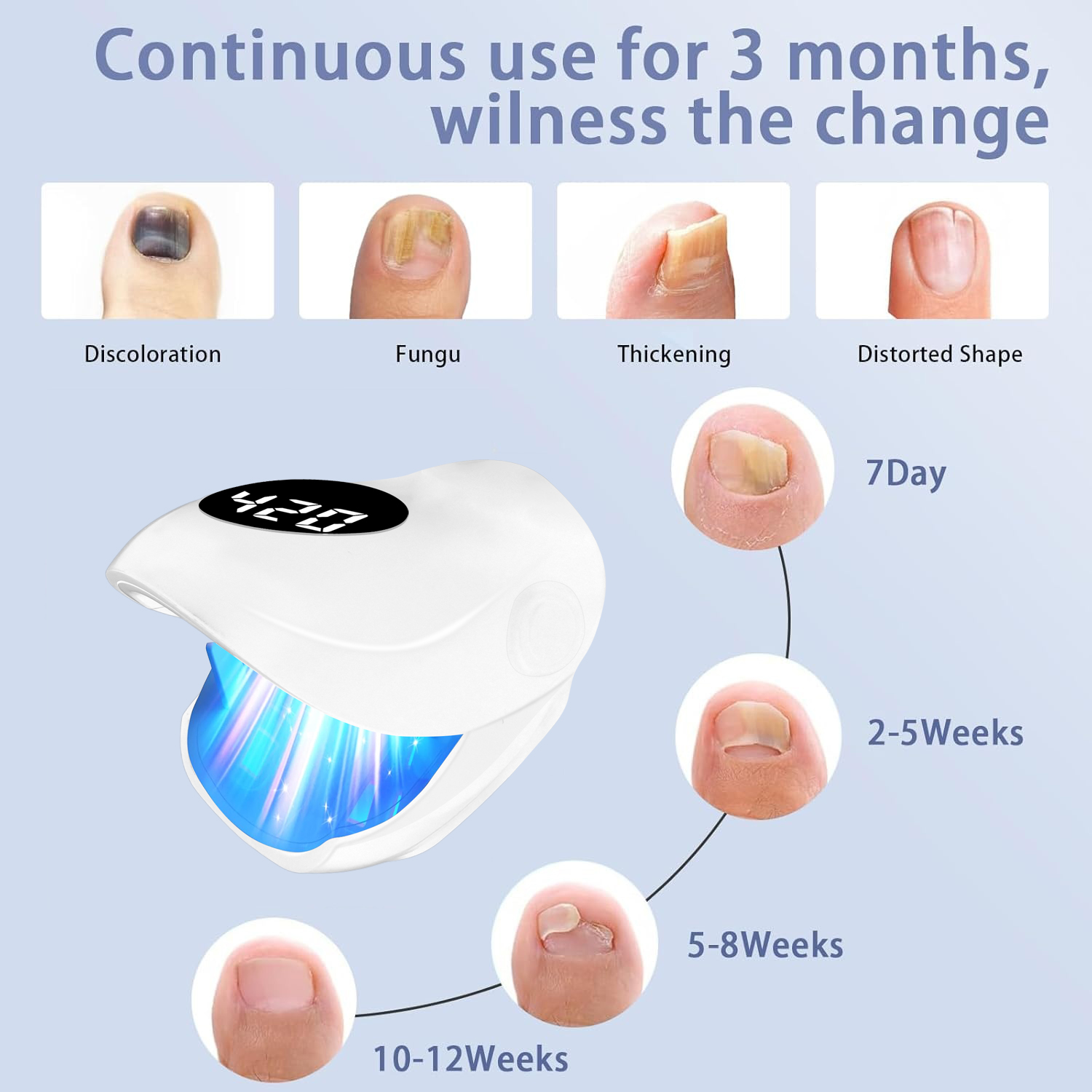 جهاز علاج فطريات الأظافر بشحن  - مراجعة Galvanic Skin Sensor وسعره